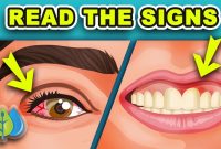 How To Recognize Symptoms Of Vitamin Deficiency In Adults