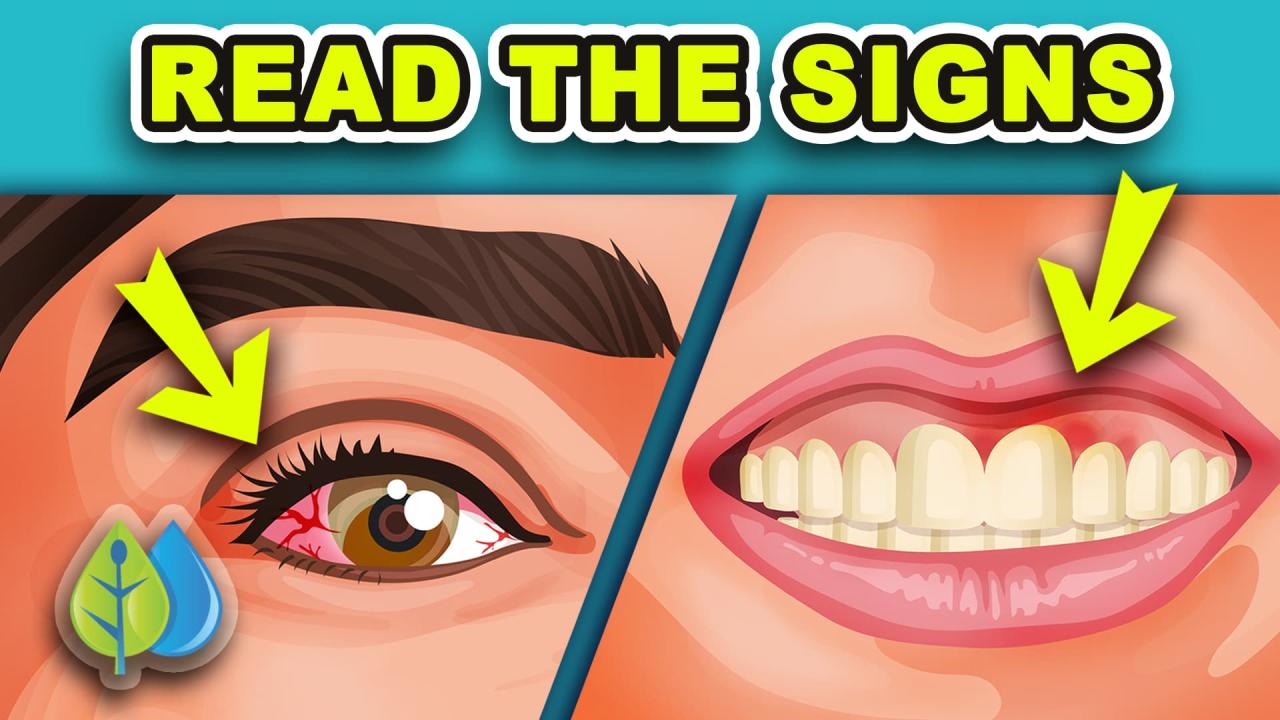 How To Recognize Symptoms Of Vitamin Deficiency In Adults